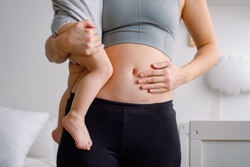 Babywearing After C-Section